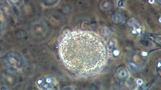 Katarzyna Warnke, Marieta Zukowska, Olga Boladz - Botoks (2017)